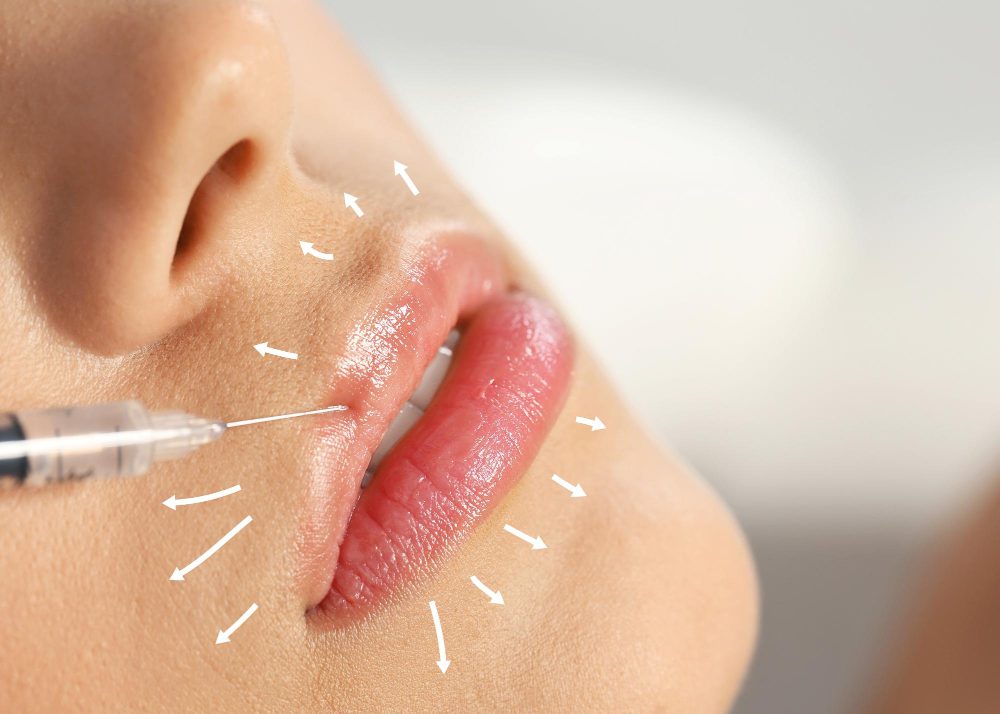 بهترین ژل و بوتاکس برای پوست حساس